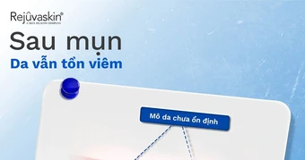 Những lưu ý chăm da sau mụn