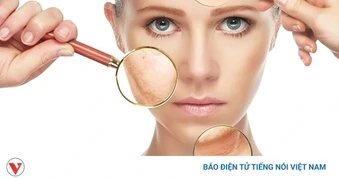 Những thực phẩm vạn người mê nhưng càng ăn da lại càng nhanh lão hóa, chảy xệ