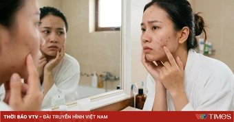 Những vitamin, khoáng chất nào tốt cho da mụn?
