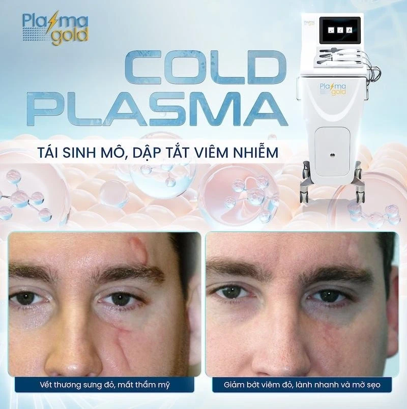 Quản trị rủi ro biến chứng hậu phẫu: Góc nhìn từ công nghệ Plasma lạnh Quản trị rủi ro biến chứng hậu phẫu: Góc nhìn từ công nghệ Plasma lạnh