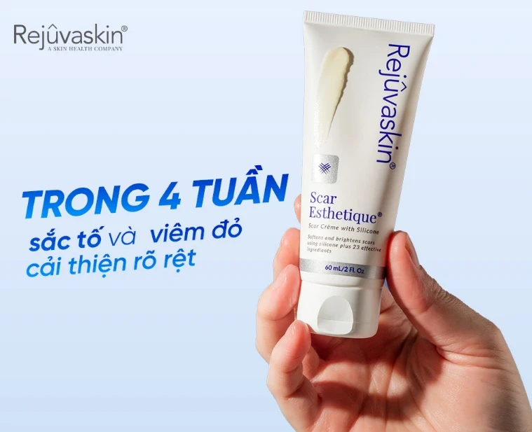 Review chi tiết kem Scar Esthetique làm mờ sẹo rỗ do mụn có tốt không? Review chi tiết kem Scar Esthetique làm mờ sẹo rỗ do mụn có tốt không?