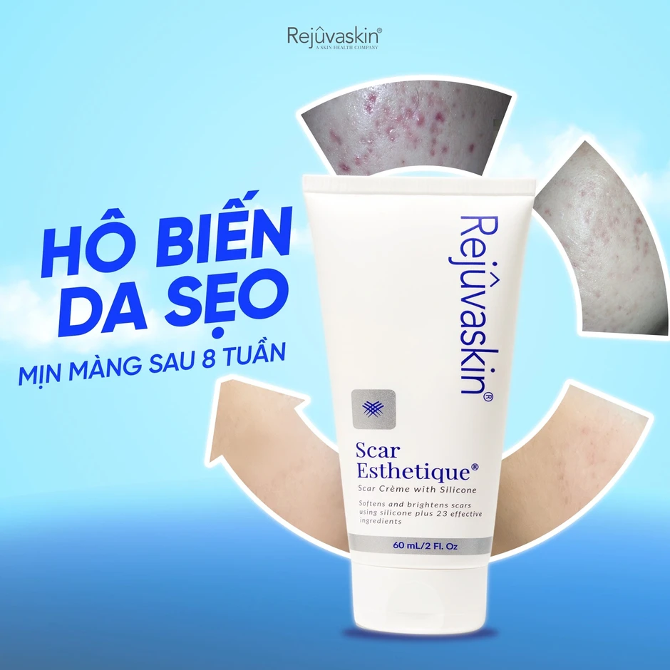 Review chi tiết kem Scar Esthetique làm mờ sẹo rỗ do mụn có tốt không? Review chi tiết kem Scar Esthetique làm mờ sẹo rỗ do mụn có tốt không?
