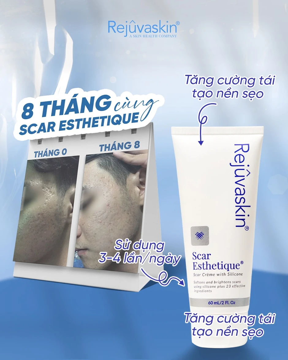 Review chi tiết kem Scar Esthetique làm mờ sẹo rỗ do mụn có tốt không? Review chi tiết kem Scar Esthetique làm mờ sẹo rỗ do mụn có tốt không?