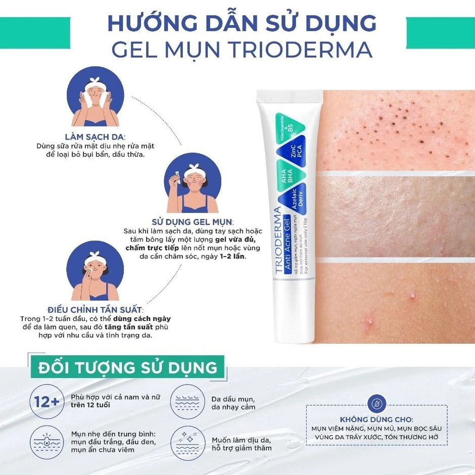 Review kem chấm mụn Trioderma Anti Acne Gel: Vì sao lọt top ‘bán chạy’ trên TikTok? Review kem chấm mụn Trioderma Anti Acne Gel: Vì sao lọt top ‘bán chạy’ trên TikTok?