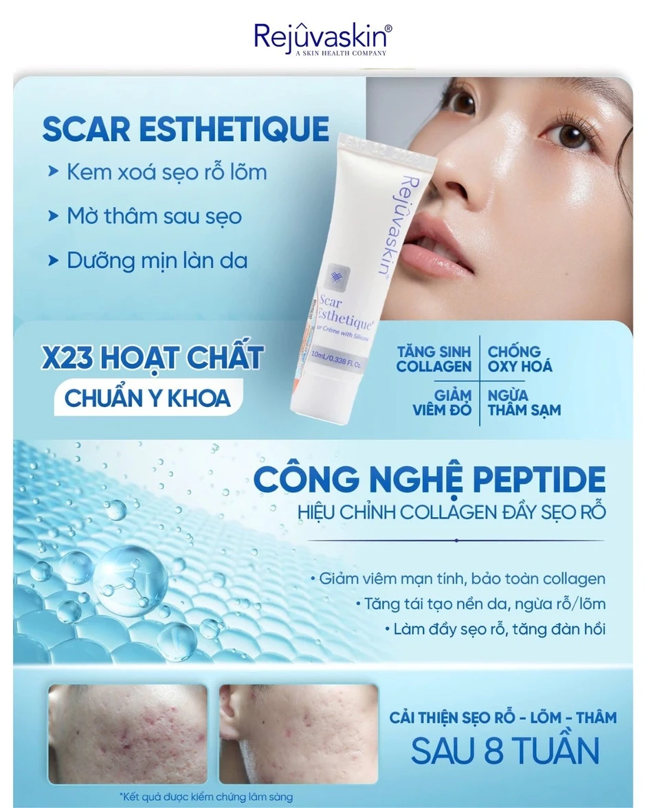 Review kem làm mờ sẹo rỗ do mụn Scar Esthetique với lượt bán top đầu trên TikTok? Review kem làm mờ sẹo rỗ do mụn Scar Esthetique với lượt bán top đầu trên TikTok?