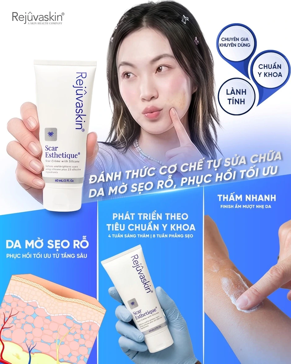 Review kem làm mờ sẹo rỗ do mụn Scar Esthetique với lượt bán top đầu trên TikTok? Review kem làm mờ sẹo rỗ do mụn Scar Esthetique với lượt bán top đầu trên TikTok?