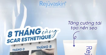 Review kem làm mờ sẹo rỗ do mụn Scar Esthetique với lượt bán top đầu trên TikTok?