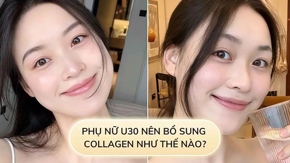Sau 30 tuổi, chị em mới bắt đầu bổ sung collagen có phải là quá muộn?