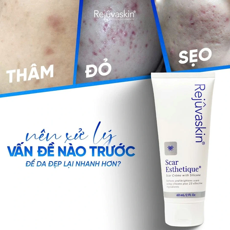 Scar Esthetique giúp mờ sẹo thâm có tốt không mà thuộc top bán chạy nhiều năm qua? Scar Esthetique giúp mờ sẹo thâm có tốt không mà thuộc top bán chạy nhiều năm qua?