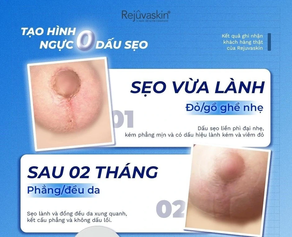 Sẹo mới: Cách xử lý hiệu quả với Scar FX và Rejuvasil Silicone Gel