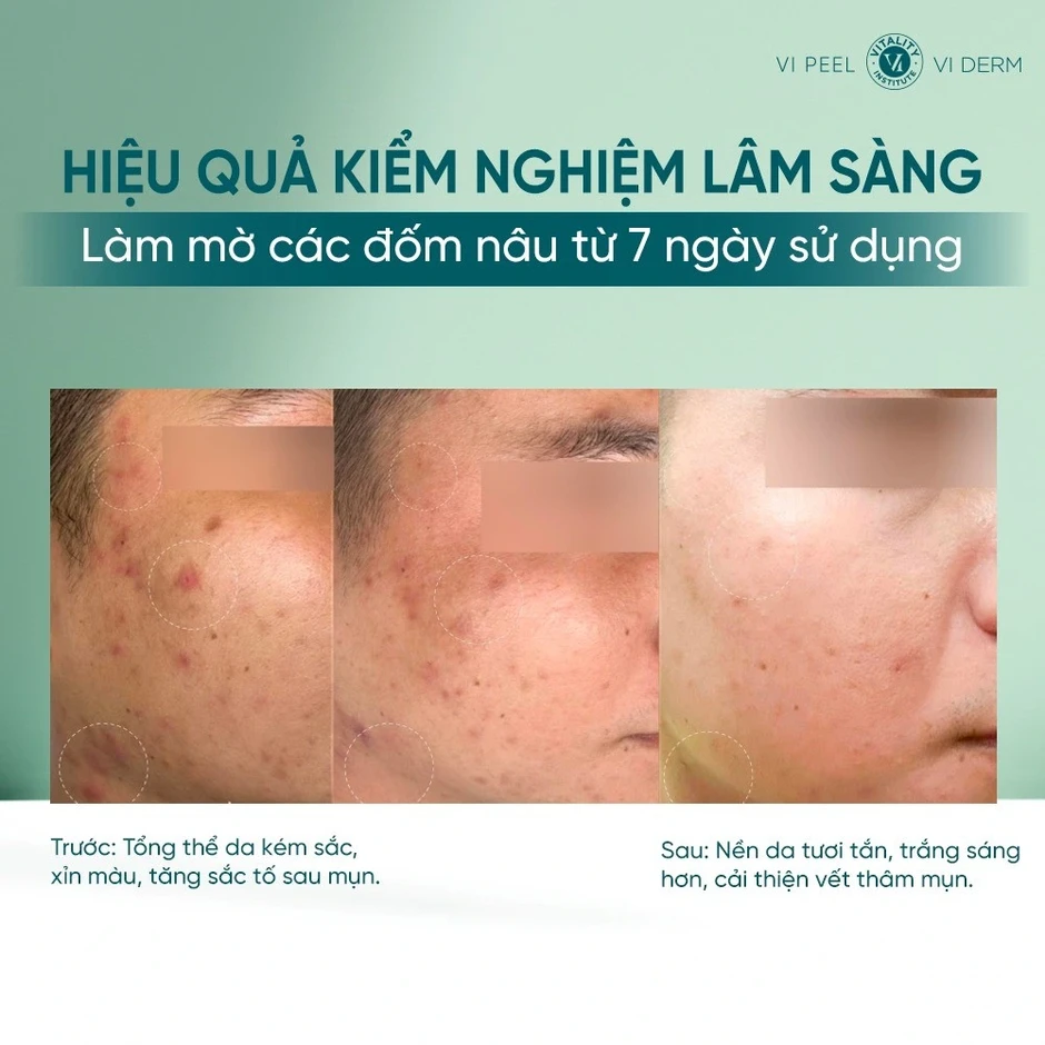 Thử ngay 5 serum trắng da này nếu da đang xỉn màu và lão hóa trước tuổi Thử ngay 5 serum trắng da này nếu da đang xỉn màu và lão hóa trước tuổi