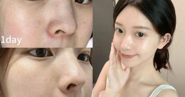 Top 3 kem chống nắng trắng da mà nàng nào cũng cần có trong hè này! Top 3 kem chống nắng trắng da mà nàng nào cũng cần có trong hè này!