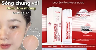 Top 3 serum tranexamic a xít mờ nám từ bên trong, da trắng sáng sau 4 tuần
