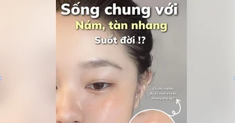 Top 3 serum tranexamic acid mờ nám từ bên trong, da trắng sáng sau 4 tuần