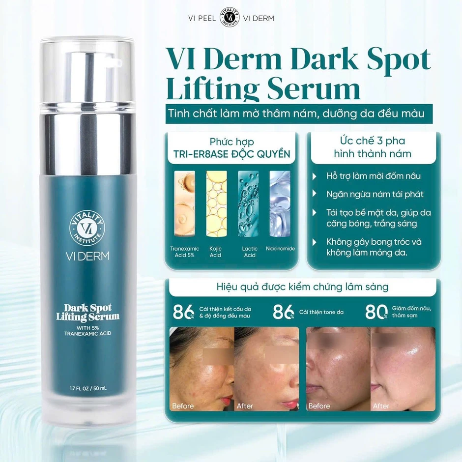 Top 3 serum tranexamic acid mờ nám từ bên trong, da trắng sáng sau 4 tuần Top 3 serum tranexamic acid mờ nám từ bên trong, da trắng sáng sau 4 tuần