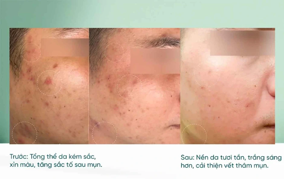 Top 3 serum vitamin C khiến làn da xỉn màu, lão hóa cỡ nào cũng tươi trẻ Top 3 serum vitamin C khiến làn da xỉn màu, lão hóa cỡ nào cũng tươi trẻ