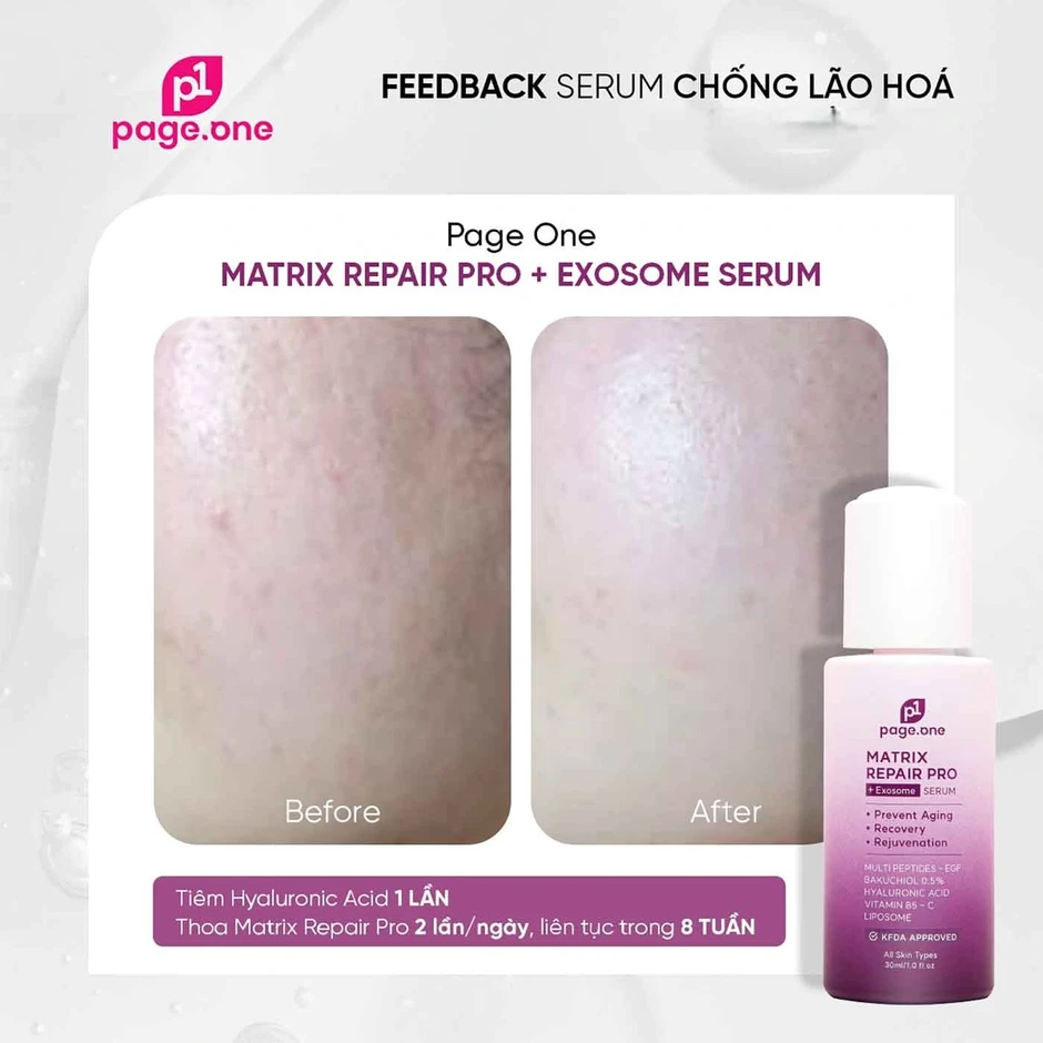 Top 3 serum vitamin C khiến làn da xỉn màu, lão hóa cỡ nào cũng tươi trẻ Top 3 serum vitamin C khiến làn da xỉn màu, lão hóa cỡ nào cũng tươi trẻ