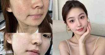 Top 5 kem chống nắng cho da khô căng mướt ‘ngậm nước’ cả ngày