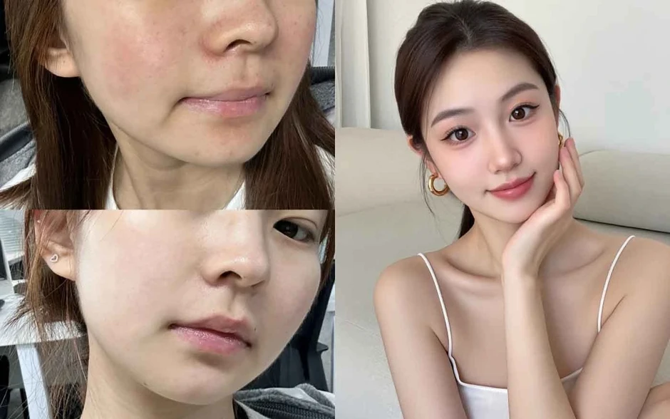 Top 5 kem chống nắng cho da khô căng mướt ‘ngậm nước’ cả ngày Top 5 kem chống nắng cho da khô căng mướt ‘ngậm nước’ cả ngày