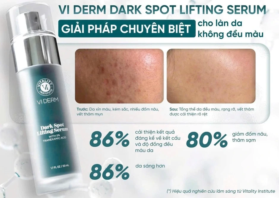 Top 5 kem giảm nám, đốm nâu hiệu quả sau 4 tuần, mờ cả nám lâu năm Top 5 kem giảm nám, đốm nâu hiệu quả sau 4 tuần, mờ cả nám lâu năm