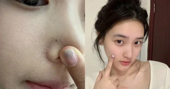 Top 5 serum cấp ẩm đang cháy hàng vì giúp da căng bóng như dùng filter