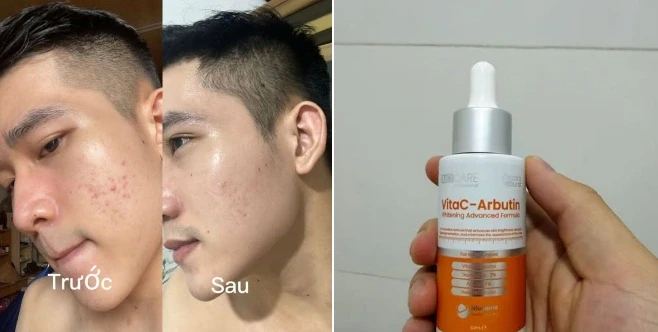 Top 6 serum giúp trắng da sau 2 tuần khiến nàng nhận ra trước giờ chọn sai Top 6 serum giúp trắng da sau 2 tuần khiến nàng nhận ra trước giờ chọn sai