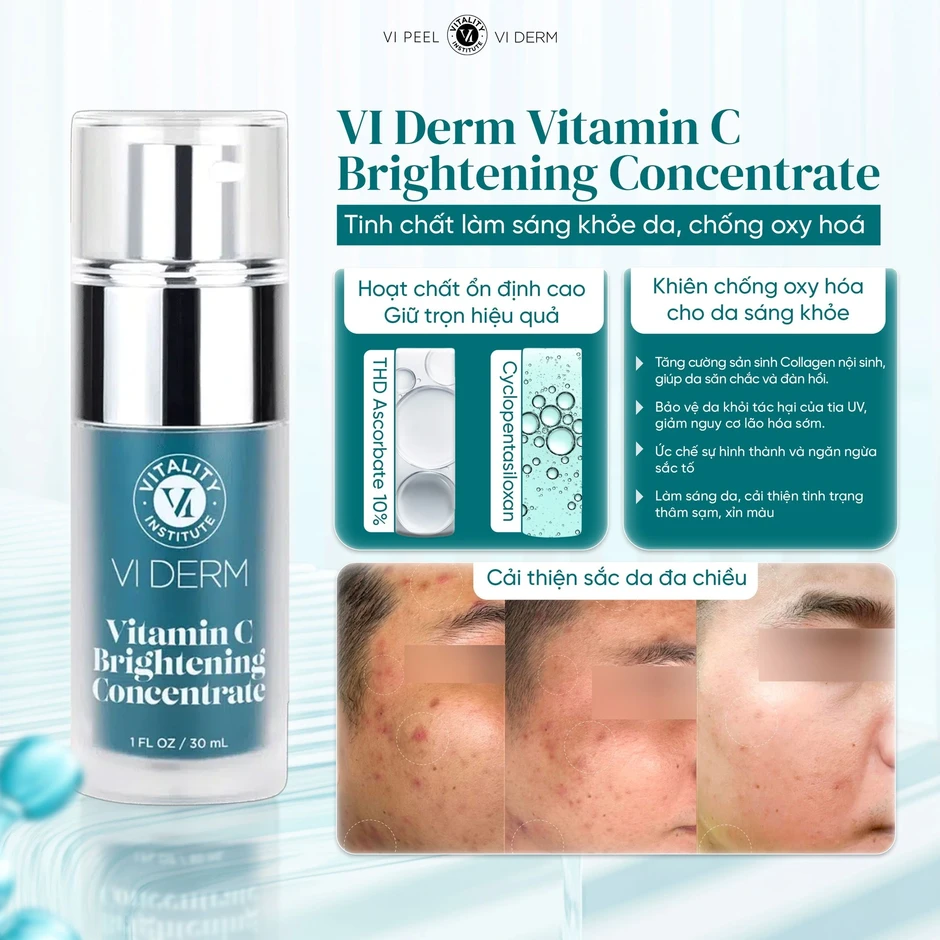 Top 6 serum giúp trắng da sau 2 tuần khiến nàng nhận ra trước giờ chọn sai Top 6 serum giúp trắng da sau 2 tuần khiến nàng nhận ra trước giờ chọn sai