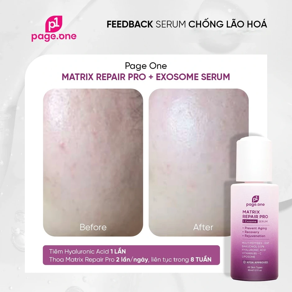 Top 6 serum giúp trắng da sau 2 tuần khiến nàng nhận ra trước giờ chọn sai Top 6 serum giúp trắng da sau 2 tuần khiến nàng nhận ra trước giờ chọn sai