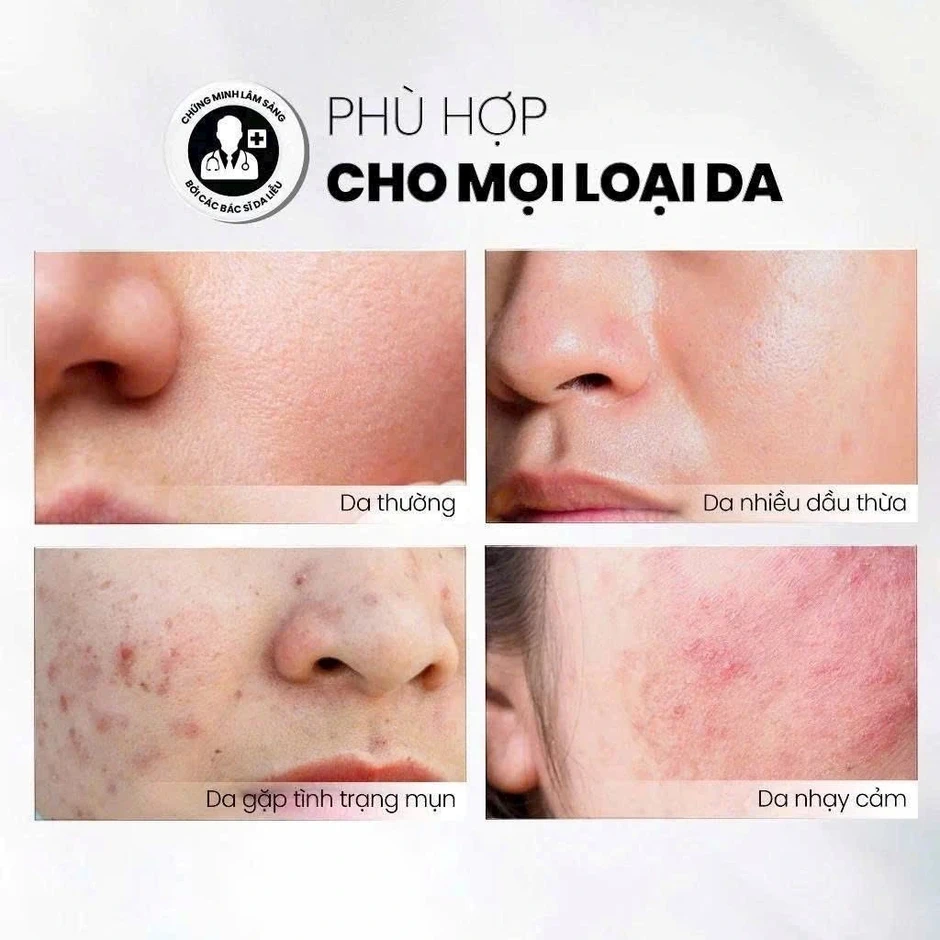 Top 7 sữa rửa mặt cho da dầu mụn sạch sâu, giảm bóng nhờn dù đang hè