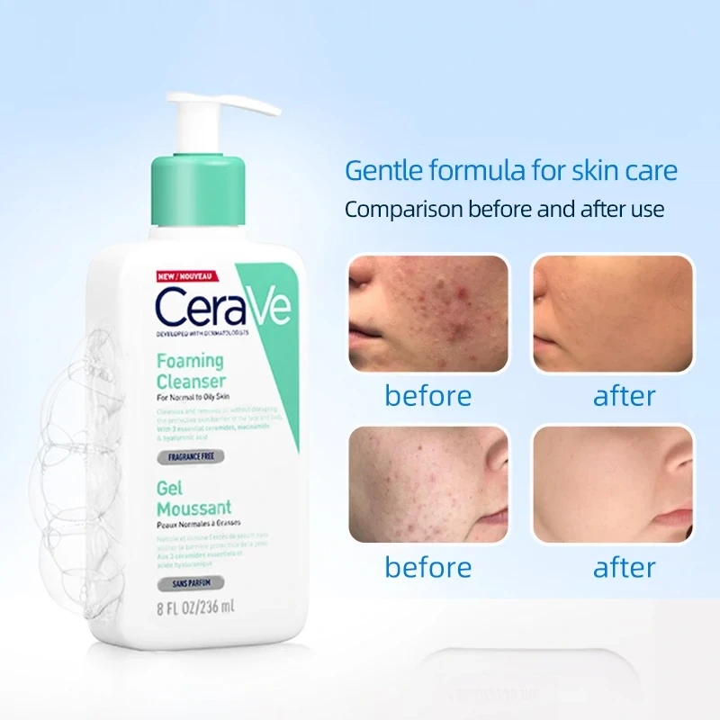 Top 7 sữa rửa mặt cho da dầu mụn sạch sâu, giảm bóng nhờn dù đang hè