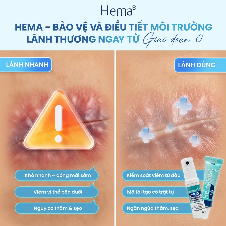 Từ chăm sóc truyền thống đến phục hồi chủ động với Hema Từ chăm sóc truyền thống đến phục hồi chủ động với Hema