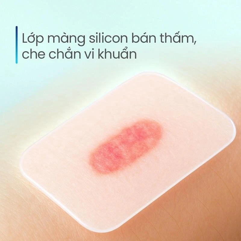 Vết loét lâu lành và nguy cơ hoại tử, dừng ngay việc tự xử lý tại nhà Vết loét lâu lành và nguy cơ hoại tử, dừng ngay việc tự xử lý tại nhà