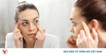 Vì sao bôi kem mắt mãi vẫn không hết quầng thâm, bọng mắt?