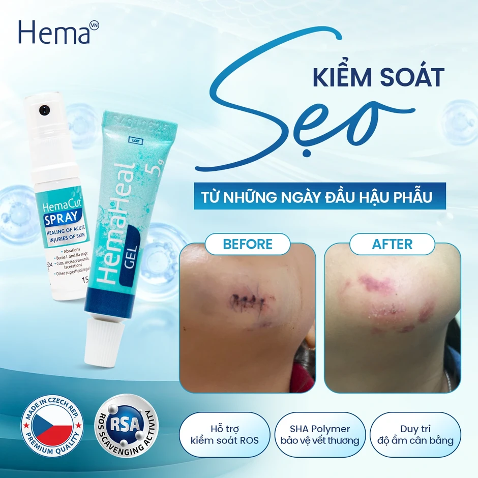 Vì sao giai đoạn đầu mang tính quyết định đến kết quả hồi phục? Vì sao giai đoạn đầu mang tính quyết định đến kết quả hồi phục?