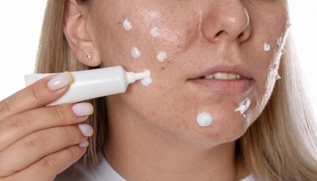 Vì sao nhiều người trị sẹo mãi không hiệu quả dù rất chăm skincare? Vì sao nhiều người trị sẹo mãi không hiệu quả dù rất chăm skincare?