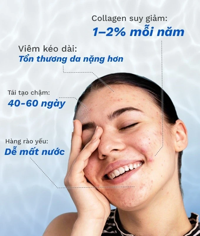 Vì sao skincare rất nhiều nhưng da sau mụn vẫn không đẹp lên? Vì sao skincare rất nhiều nhưng da sau mụn vẫn không đẹp lên?