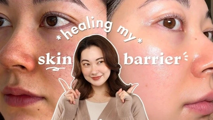 Xu hướng ‘skin barrier first’ khiến hội mê treatment cũng phải 'quay xe'