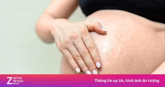 Bác sĩ chỉ 3 cách giúp mẹ bầu giảm nguy cơ rạn da