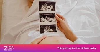 Bác sĩ Từ Dũ chỉ ra những việc phụ nữ cần làm 3 tháng trước khi mang thai