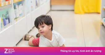 Bệnh còi xương ở trẻ: Những điều cha mẹ nhất định phải biết