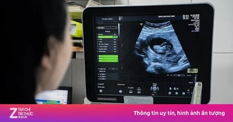 Dấu hiệu sớm nhận biết mang thai