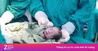 Mẹ 28 tuổi mang tam thai tự nhiên cực hiếm