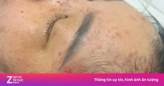 Thai phụ 18 tuần nhập viện sau khi tiếp xúc trẻ mắc bệnh truyền nhiễm
