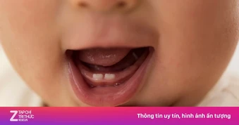 Thời điểm trẻ bắt đầu mọc răng