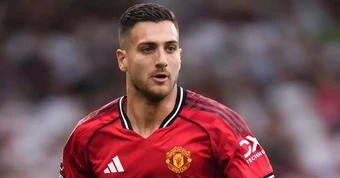 Rõ lý do Dalot bị gạch tên trận gặp Brighton