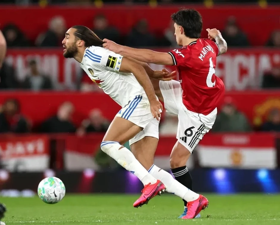 Từ thẻ đỏ tranh cãi của MU, FIFA cần cấm cầu thủ để tóc dài