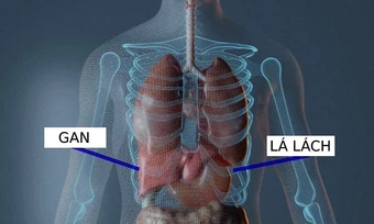 Bác sĩ Mỹ bị truy tố vì cắt nhầm nội tạng khiến bệnh nhân tử vong