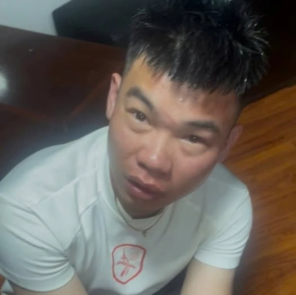 Bé trai 14 tuổi ở Hà Nội bị ném gạch vào đầu dẫn đến chấn thương sọ não Bé trai 14 tuổi ở Hà Nội bị ném gạch vào đầu dẫn đến chấn thương sọ não