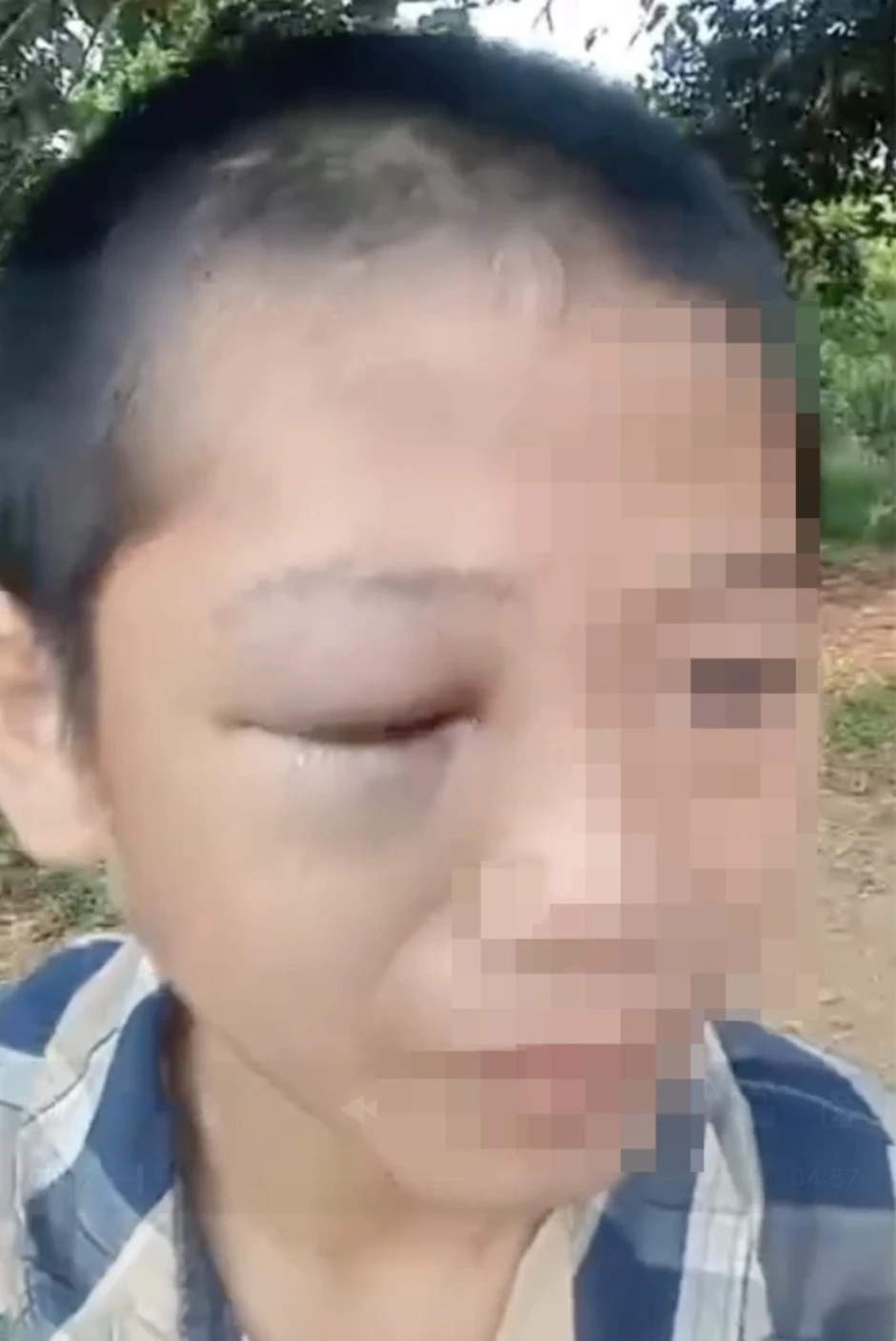 Bé trai lớp 6 khóc cầu cứu, nghi bị cha và mẹ kế bạo hành Bé trai lớp 6 khóc cầu cứu, nghi bị cha và mẹ kế bạo hành