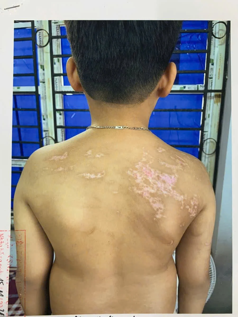 Con tiếp thu bài chậm, bố dùng dây sạc điện thoại quất thâm tím người Con tiếp thu bài chậm, bố dùng dây sạc điện thoại quất thâm tím người